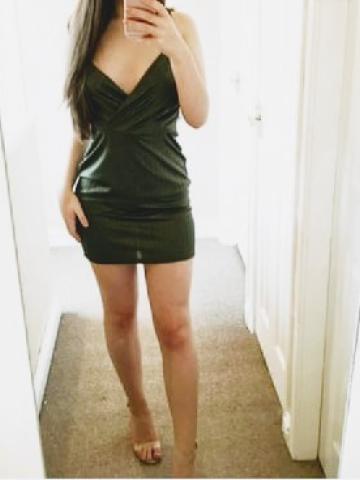 Лилия фото 2